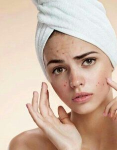 Healthy Skin with Proper Skincare Routine